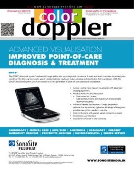 Color Doppler